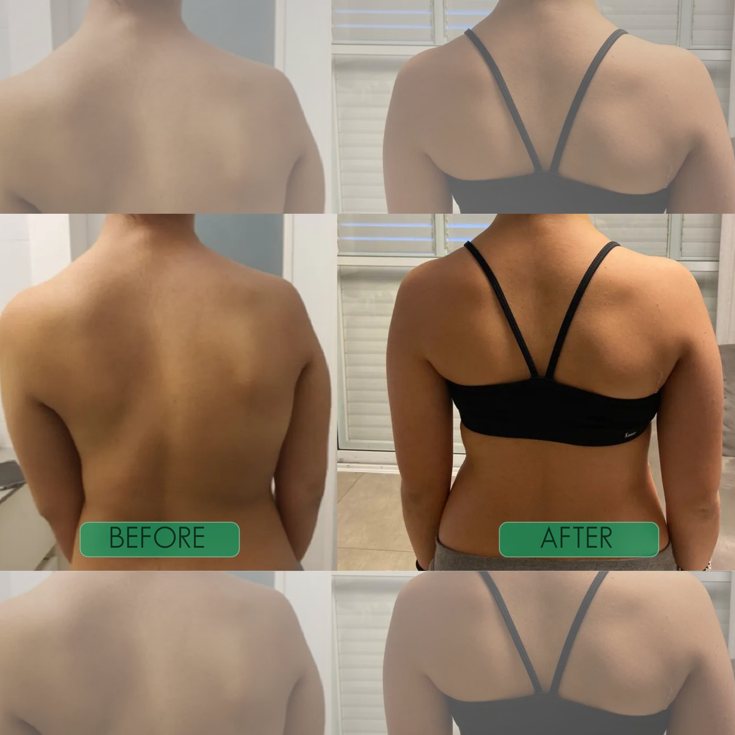 CoreCare Instant Posture Support Brace