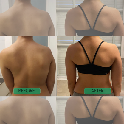 CoreCare Instant Posture Support Brace